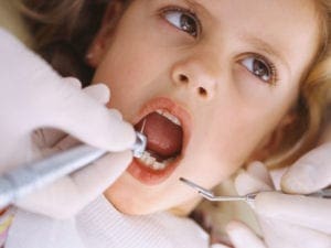 Teeth cleaning