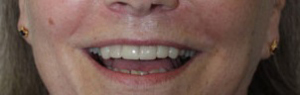 After After