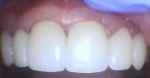 After After