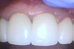 After After